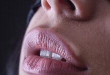 “아무리 바르고 발라도 입술이 갈라져요”… 만성 입술건조, 영양 결핍 신호일 수 있습니다 person with red lipstick and black mascara