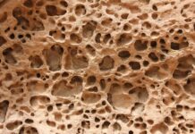 골다공증 예방과 뼈 건강 a close up of a rock with holes in it